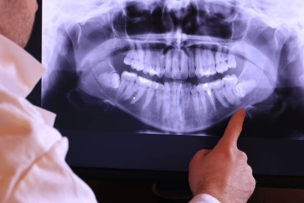 Best Holiday Emergency Dentist in Refugio, TX